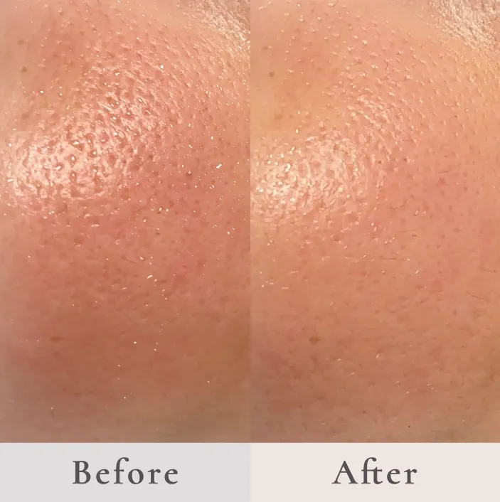 シワ・タルミの原因となる筋肉に直接アプローチする 世界にひとつのリフティングメソッド