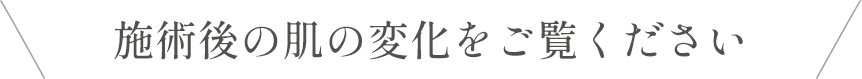 施術後の肌の変化をご覧ください