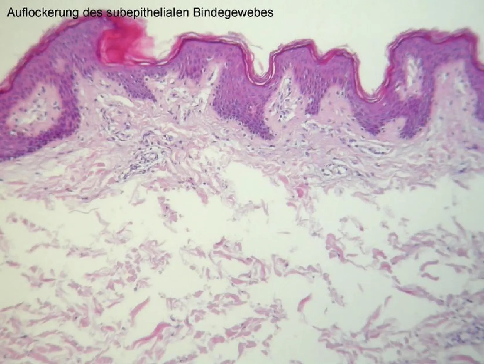 毛穴が小さくなり表皮が引き締まった肌
