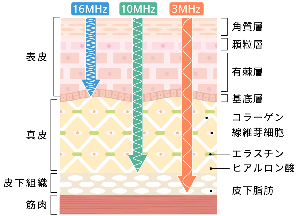 表情筋を引き上げる独自開発リフティングマシン